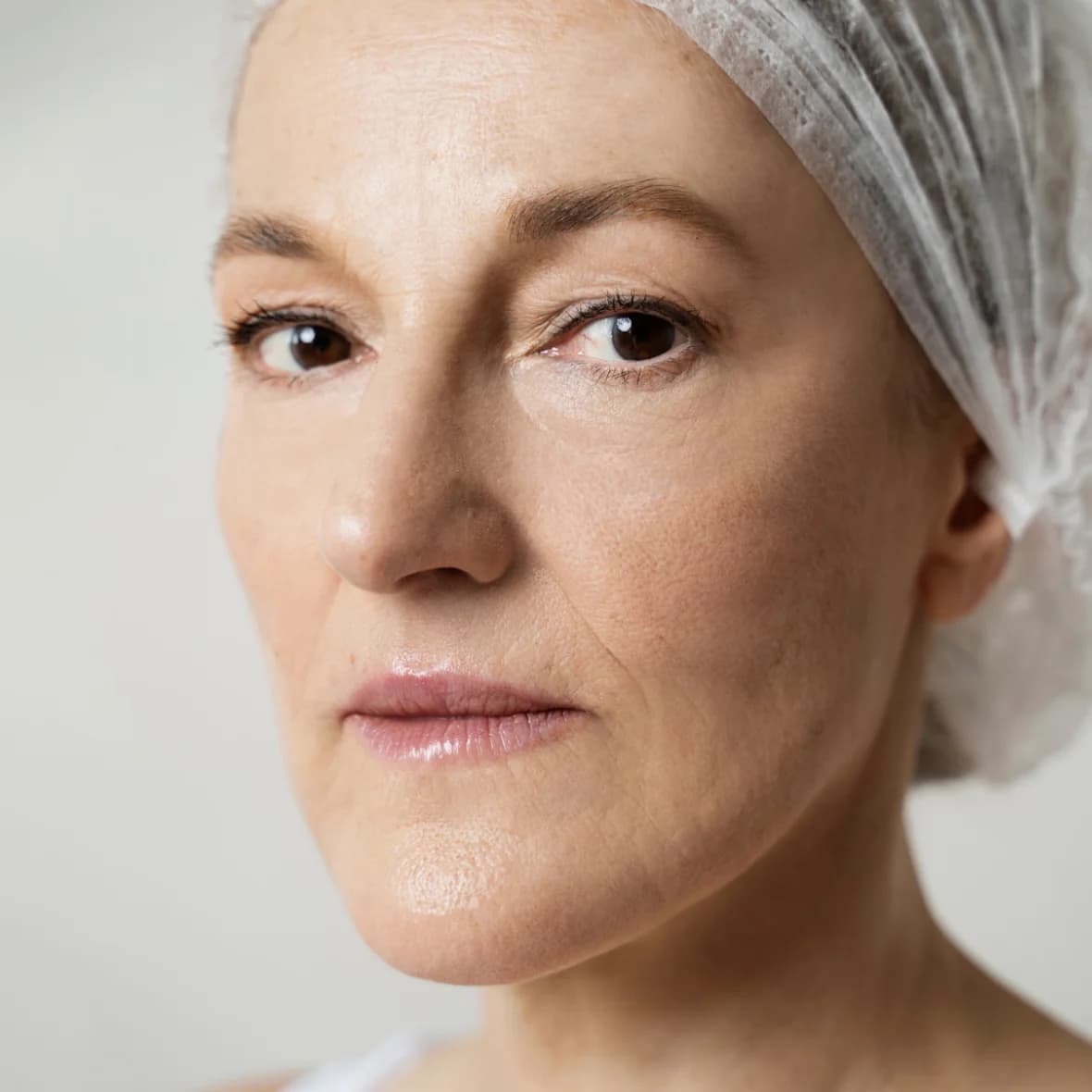 Skin Rejuvenation - After