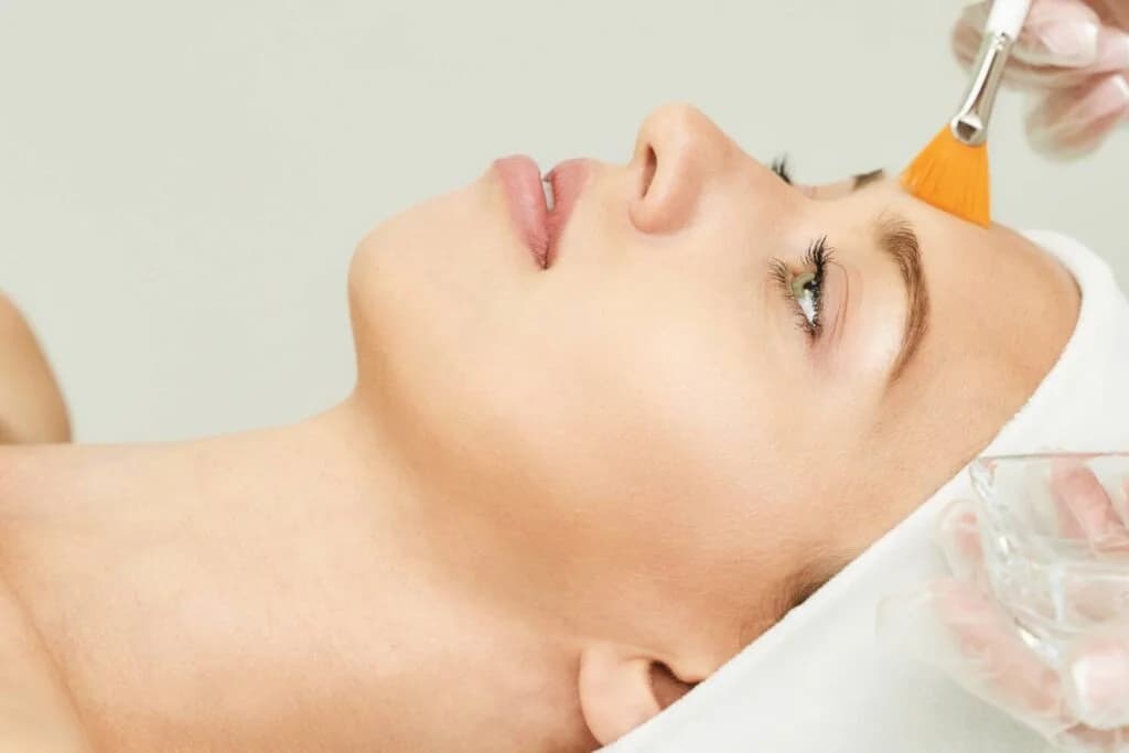 Chemical Peels treatment 4