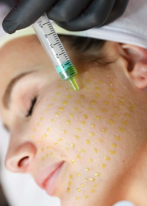 BioRePeel treatment at Rani Beauty Clinic Renton