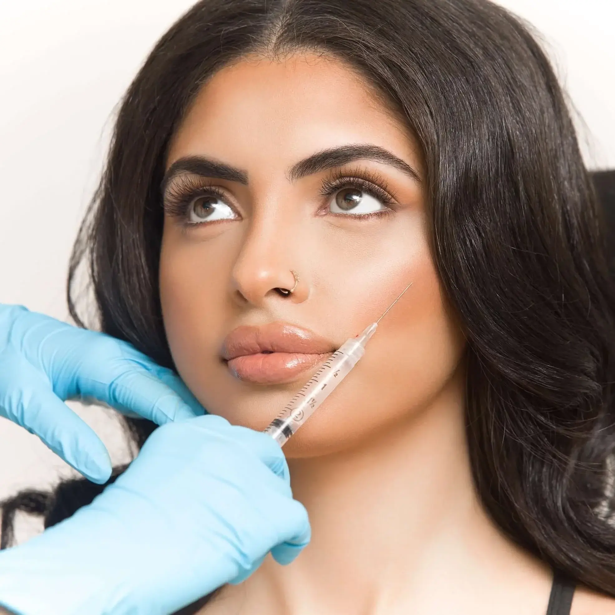 Dermal Fillers treatment 3
