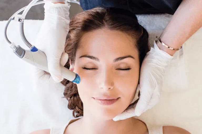 Laser Acne Facial treatment at Rani Beauty Clinic Renton