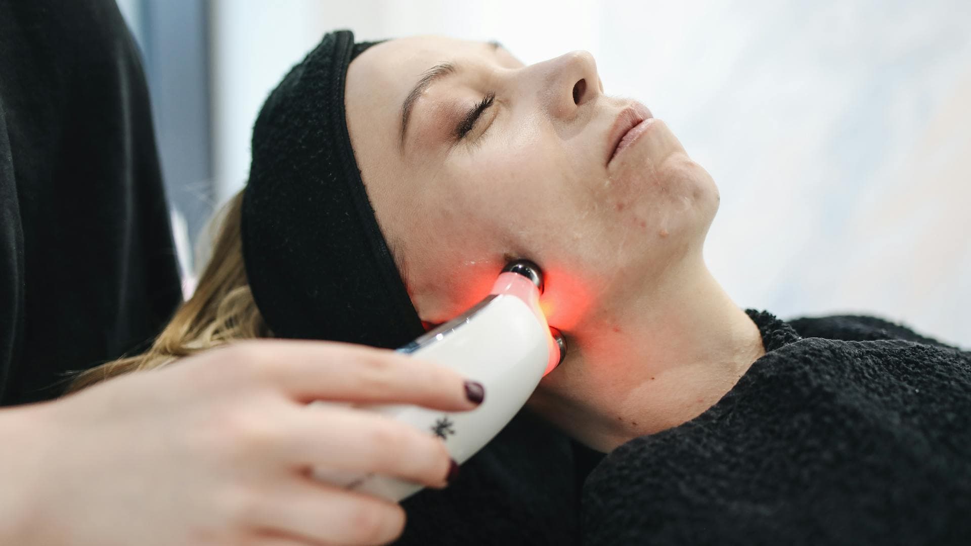 Laser Hair Removal Before & After