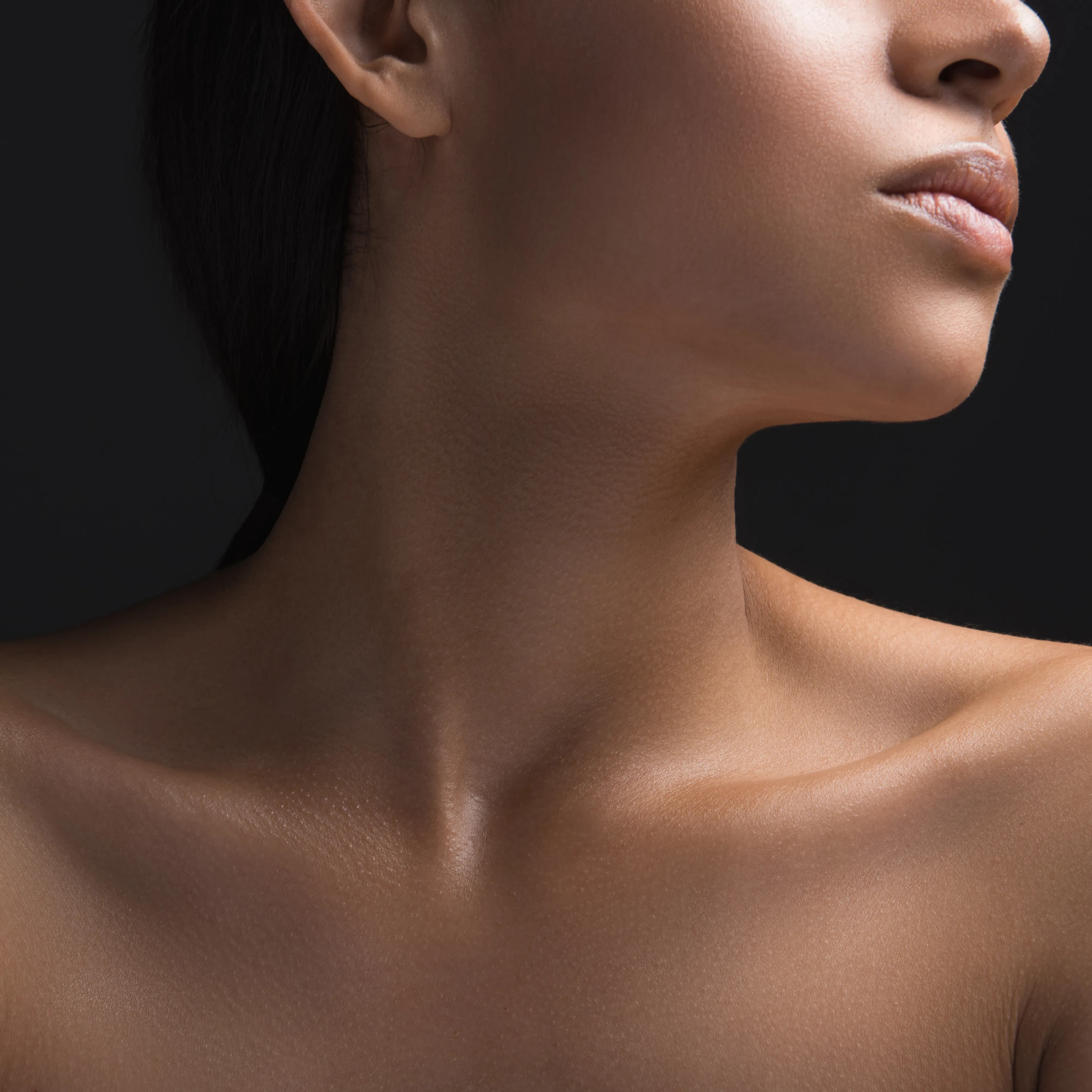Sofwave treatment 3