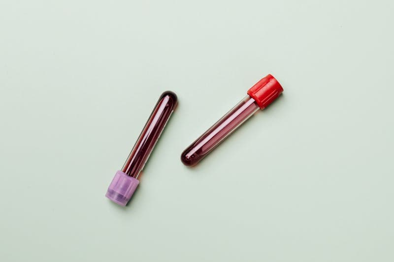 Blood Work treatment at Rani Beauty Clinic Renton